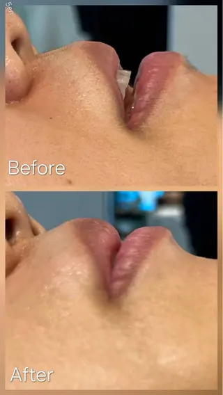 シュガーリング/脱毛 EARLS三軒茶屋のエステ・リラクイメージ