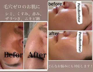 美肌管理サロン　ペルボヌール所属・韓国美肌管理サロン ペルボヌールのエステ・リラクイメージ
