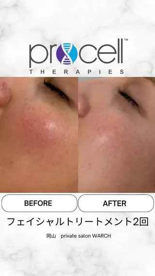 WARCH Marieのその他イメージ