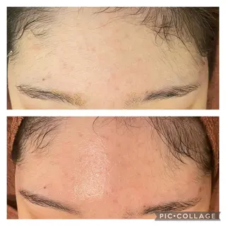 セミロング カラー パーマ ヘアアレンジ メンズ キッズ ネイル マツエク・マツパ アイブロウ ニキビ特化型エステ 🍓最短で肌質改善のエステ・リラクイメージ