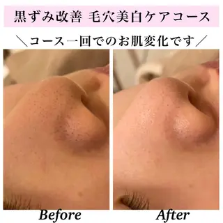 Bellesthe （ベルエステ）のエステ・リラクイメージ