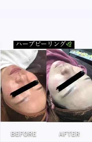 美容整体・塗る漢方・フェイシャルRechica所属・心斎橋痩身 美肌整体サロン💓のエステ・リラクイメージ