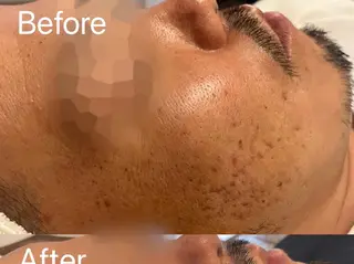 メンズ 韓国肌管理Belle 神戸元町のエステ・リラクイメージ