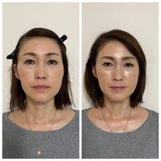 【ハーブピーリング】 Allumentのエステ・リラクイメージ