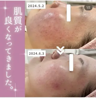 【現役看護師】高来 笑子のエステ・リラクイメージ