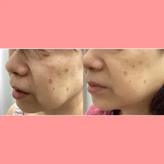 美肌専門サロン RUBONのエステ・リラクイメージ