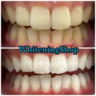 ホワイトニング ショップ吉祥寺店のエステ・リラクイメージ