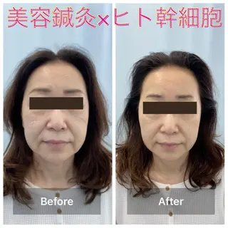 gomi sayakaのエステ・リラクイメージ