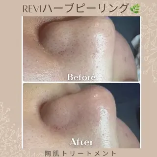 ..Belire.Revi所属・ベリールルヴィ ベリールルヴィのエステ・リラクイメージ