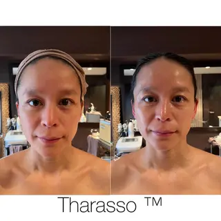 WINBACK salon　un agio所属・サロンドアンアージョ un agioのエステ・リラクイメージ