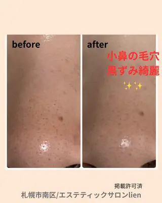 エステティックサロン　リアン所属・hiro_ narisのエステ・リラクイメージ