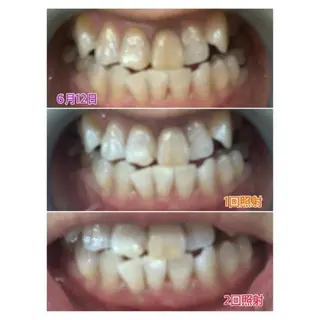 M渋谷店所属・M渋谷 ホワイトニングのその他イメージ