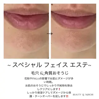ビューティー ミロワールのエステ・リラクイメージ
