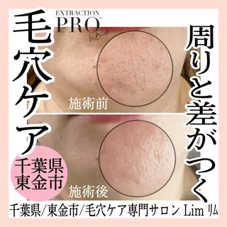 Lim Naomiのマツエク・マツパデザイン