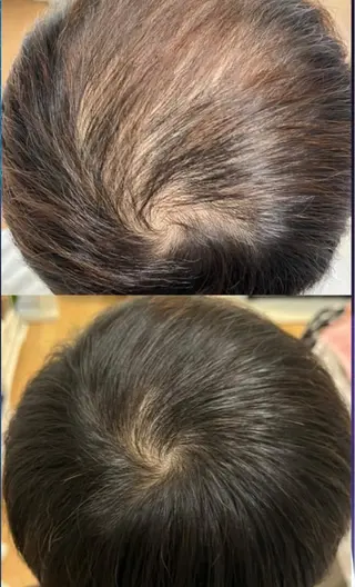 メンズ Blooming所属・LOUISE. ／肌質・頭皮のエステ・リラクイメージ