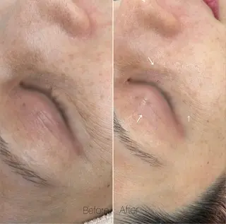 〈etre〉トータルビューティーサロン所属・etre - 韓国肌管理 -のエステ・リラクイメージ