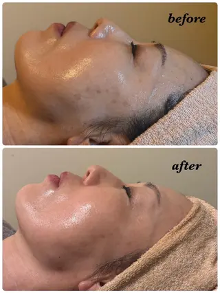 ECLAT所属・プライベートサロン✢ Eclatエクラ　のエステ・リラクイメージ