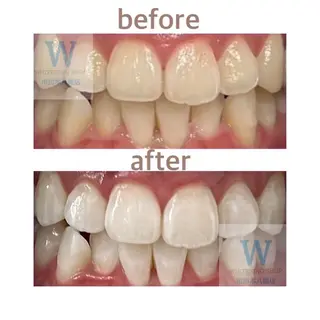 ホワイトニング ショップ本八幡店のエステ・リラクイメージ