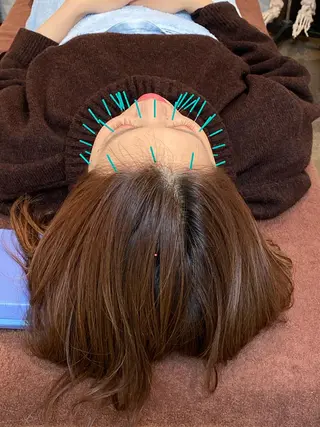 鍼灸整体院　蕾所属・美容鍼 蕾【谷町六丁目】のエステ・リラクイメージ