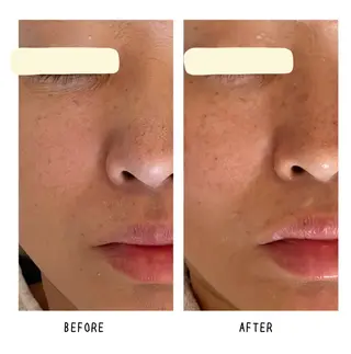 grow所属・Yoshino Erinaのエステ・リラクイメージ