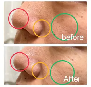 【堺市/泉ヶ丘駅】フェイシャルエステサロンSalon de jewel'm所属・Salon de jewel'm なおのエステ・リラクイメージ