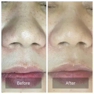 肌質改善サロン facialmoonのエステ・リラクイメージ