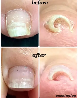 ネイル R*NAIL .comのネイルデザイン