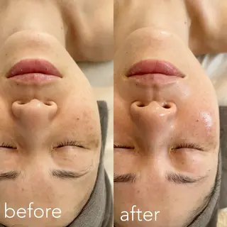 エステティックサロン Liente(リアンテ)所属・Hashimoto .のエステ・リラクイメージ