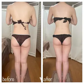 biloop所属・《痩身×疲労改善》 BILOOPのエステ・リラクイメージ