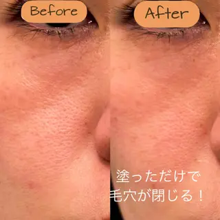 谷九上本町REINE YUKIのエステ・リラクイメージ