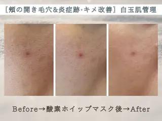 swan(スワン) 韓国肌管理 南堀江のエステ・リラクイメージ