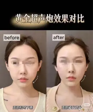 マツエク・マツパ aliaハイフ&水光ジェットサロン所属・aliaハーブ水光店 エステティシャン募集のエステ・リラクイメージ