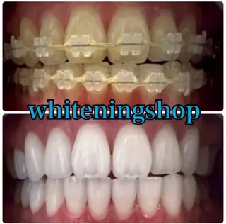 ホワイトニングショップせんげん台店所属・スタッフ 兎洞のその他イメージ