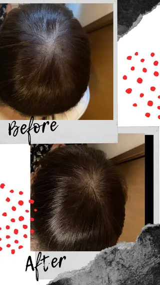 ミディアム ヘアアレンジ Kanal Kanaのエステ・リラクイメージ