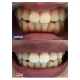 M渋谷店所属・Ｍ渋谷 ホワイトニングのその他イメージ