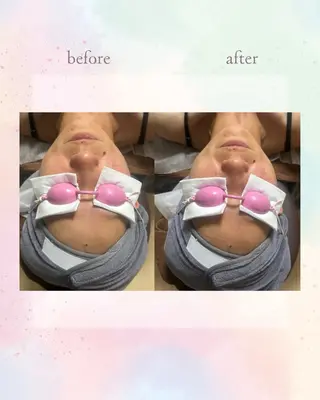 Belle ＋vi（ベル）のその他イメージ