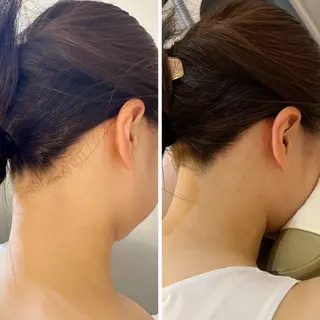 うなじ脱毛/美肌脱毛 LABELのエステ・リラクイメージ