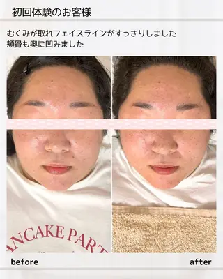 小顔矯正& 慢性肩こり腰痛改善店のエステ・リラクイメージ