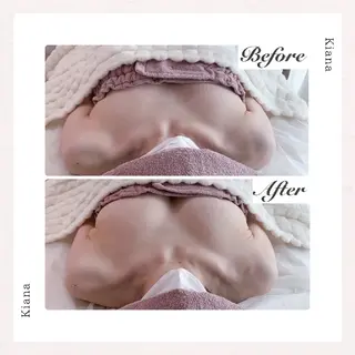 【バスト専門店 】 Kiana のエステ・リラクイメージ