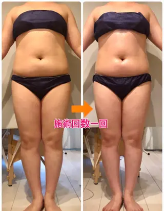 ミディアム カラー パーマ ヘアアレンジ メンズ キッズ ネイル マツエク・マツパ ‍痩身＆ボディ 結果出し🌟丹野のエステ・リラクイメージ