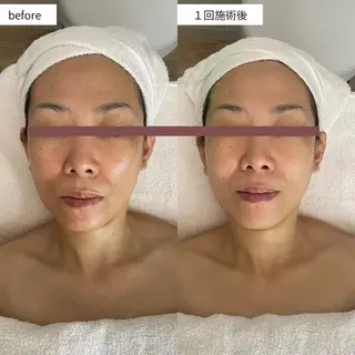 なにわのシミ取り職人 YUKIのエステ・リラクイメージ