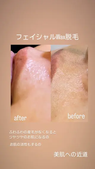 ワックス脱毛🌈 ESPOIRnocoのエステ・リラクイメージ