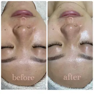 salon　Ravim所属・salon Ravimのエステ・リラクイメージ