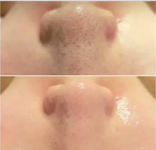 NaKid マツエク&マツパのマツエク・マツパデザイン