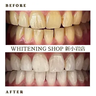 メンズ ホワイトニング ショップ新小岩店のその他イメージ