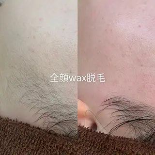 EST BEAUTY所属・顔ワックス脱毛/ ハーブピーリングのエステ・リラクイメージ