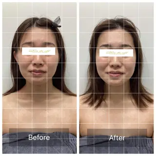 メディカルサロンドオフ所属・ハリサロンドオフ 美容鍼灸×小顔整体のエステ・リラクイメージ