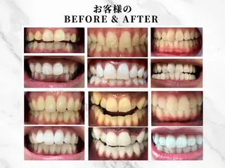 セルフホワイトニングサロンKiratt札幌店💎所属・Kiratt 札幌店のその他イメージ