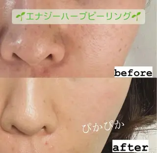 Tipani beaute'所属・Tipani beaute'のエステ・リラクイメージ