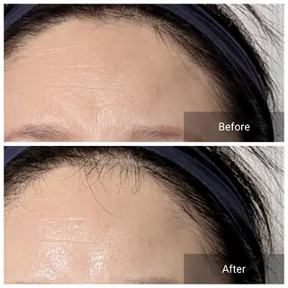 nail RiRi アトレナチュラのエステ・リラクイメージ